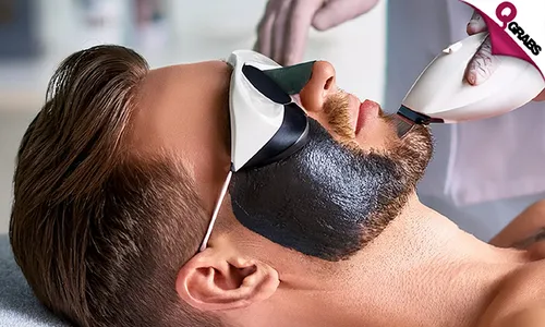 Carbon Peel & Laser Skin Lightening/Toning for Ladies & Men!